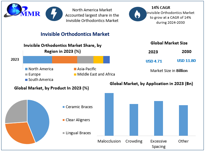 Invisible Orthodontics Market : Major Player | BEX Co. Ltd